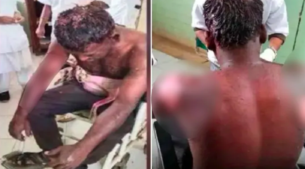 Mohammed Shabbir sets Hindu man on fire by pouring petrol for applying Holi colours on him