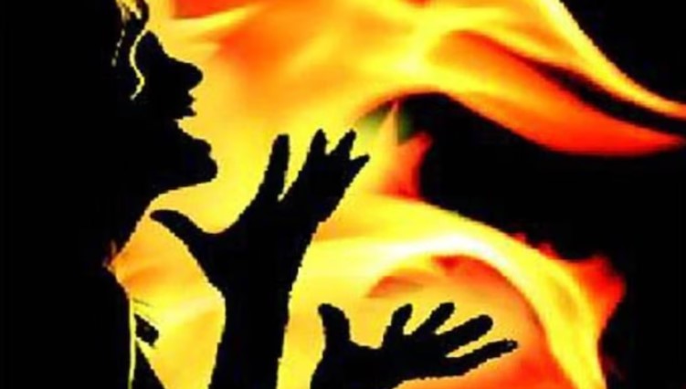 Muslim man lures Hindu woman with promise of getting her a job, holds her hostage, burns her on refusal to convert to Islam
