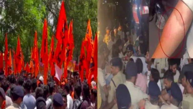 Severed calf's head found in Chhattisgarh's Durg, Hindu organisations protest