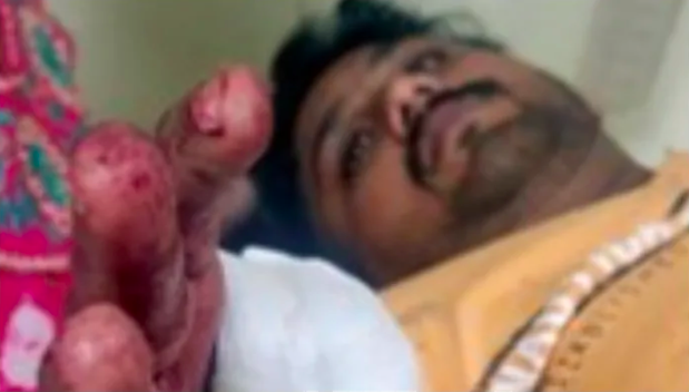 Dalit Hindu activist brutally attacked by Muslims over his association with BJP and opposition to Muslim radicals