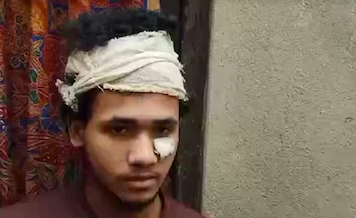 Indian Hindu boy assaulted by Muslim mob after confirming his religion