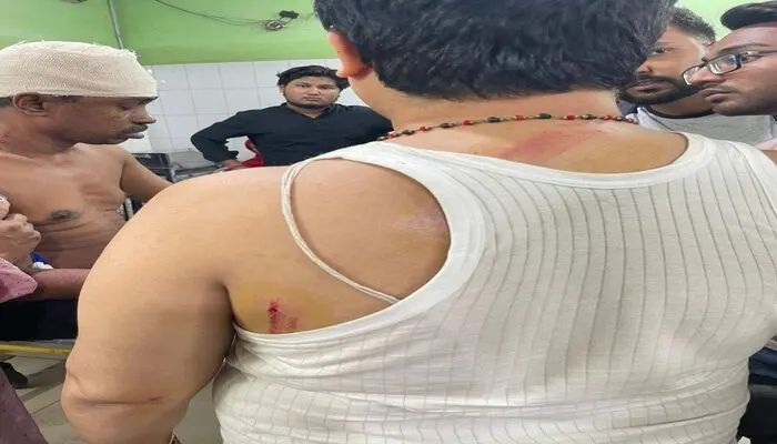 Two Hindu lawyers attacked for fighting a legal battle for Hindu saint Chinmoy Prabhu in Bangladesh