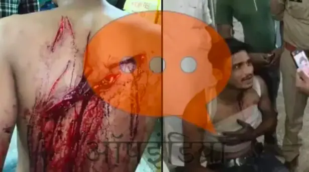 Hindu outfit member attacked for his religious identity, Muslim youths ask his name before stabbing him