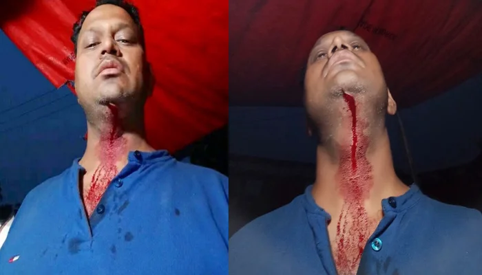 Hindu leader violently attacked by Islamists in Bangladesh