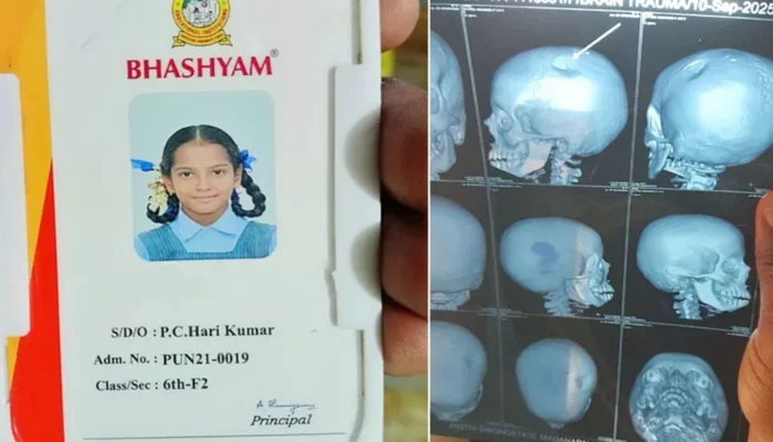 Minor Hindu student suffers fractured skull after brutal assault by Muslim teacher in Andhra Pradesh