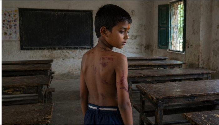 Hindu child beaten with iron rod by Muslim teacher for wearing tilak in Uttar Pradesh