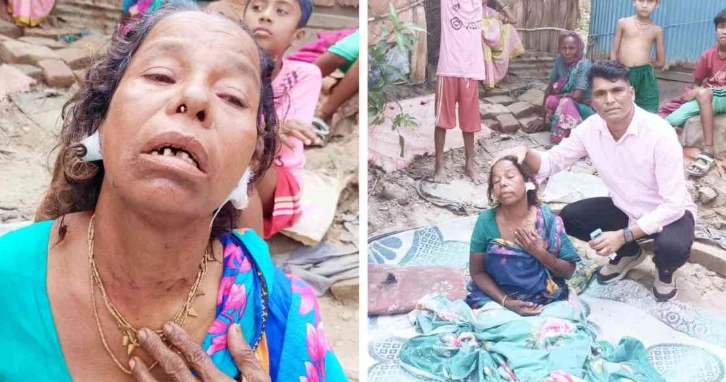 Hindu woman brutally attacked and looted in Noakhali amidst ongoing persecution of religious minorities in Bangladesh