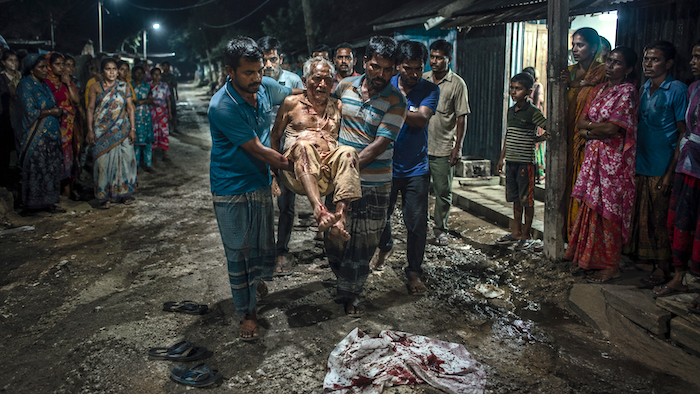 Elderly Hindu man critically injured after brutal attack by Muslim mob amidst ongoing persecution of Hindus in Bangladesh