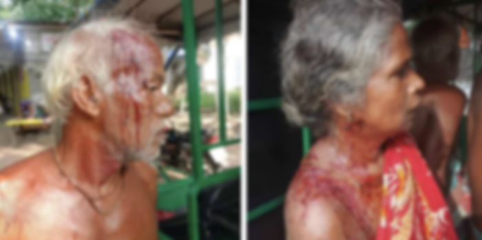 Hindu family left critically injured after brutal attack by Muslim mob in Bangladesh amidst rising attacks on Hindu minorities