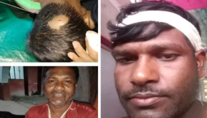 Hindu family brutally attacked, their house vandalised in Jessore amidst rising attacks on Hindu minorities in Bangladesh