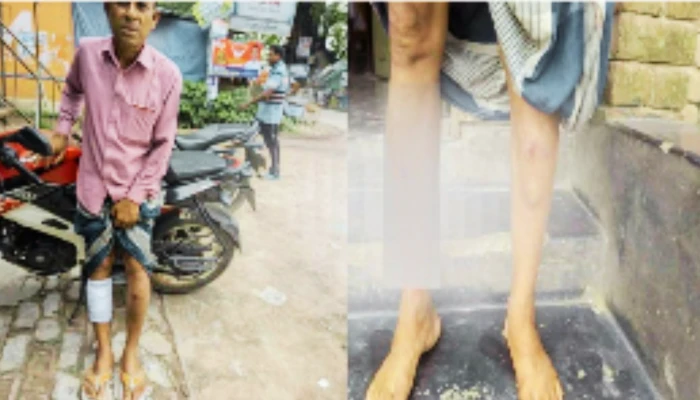 Hindu man brutally beaten and stabbed for refusing extortion demand by Muslim men in Bangladesh
