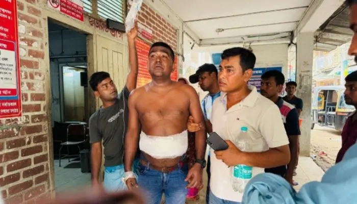 Hindu man brutally attacked and robbed by Muslims in Bagerhat amid ongoing persecution of Hindu minorities in Bangladesh
