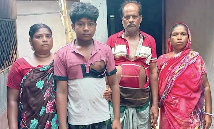 Hindu family of four including minor, beaten and injured amidst ongoing persecution of Hindu minorities in Bangladesh