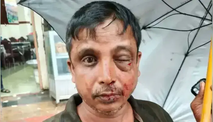 Hindu priest brutally attacked in Chittagong amidst rising attacks on Hindu minorities in Bangladesh