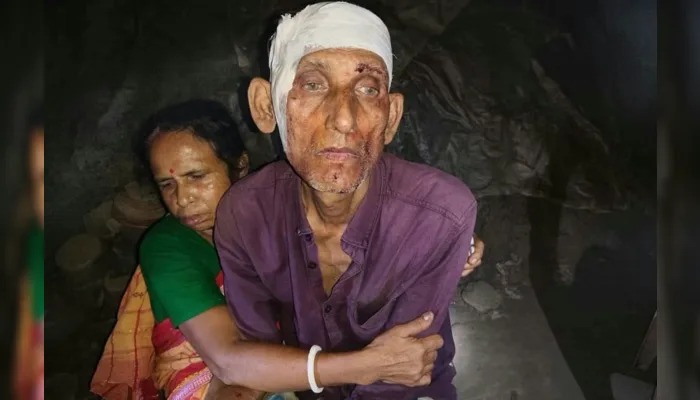 Elderly Hindu man and his son brutally assaulted in Manikganj amidst continued persecution of Hindu minorities in Bangladesh
