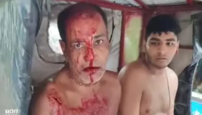 Hindu businessman and his two sons brutally attacked by Muslim man amid rising attacks on Hindu minorities in Bangladesh