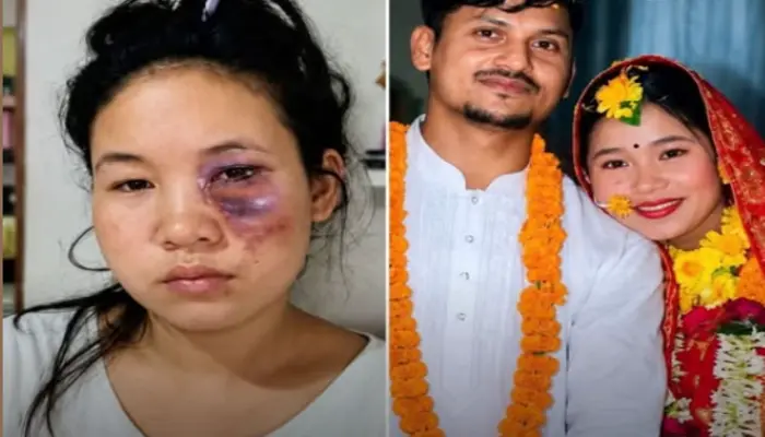 Hindu woman lured into marriage and pressured to convert to Islam by Muslim man; attacked with hot oil for refusing conversion